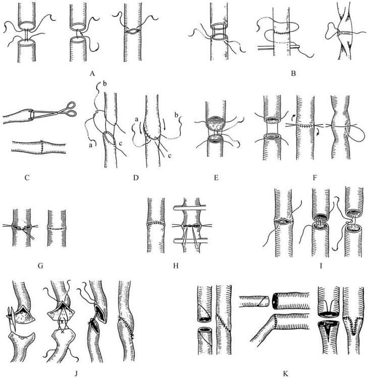 pagenumber_ebook=260,pagenumber_book=245