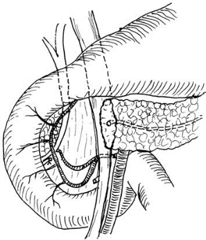 pagenumber_ebook=532,pagenumber_book=517