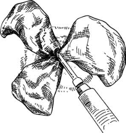 pagenumber_ebook=604,pagenumber_book=589