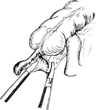 pagenumber_ebook=547,pagenumber_book=532