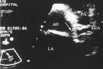 pagenumber_ebook=426,pagenumber_book=426