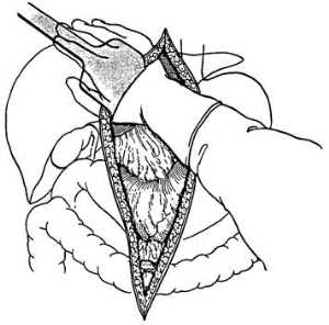 pagenumber_ebook=382,pagenumber_book=367