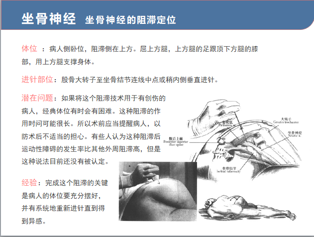 9.19 坐骨神经阻滞.png