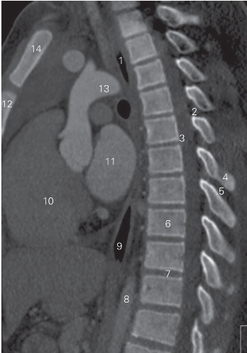 pagenumber_ebook=19,pagenumber_book=10