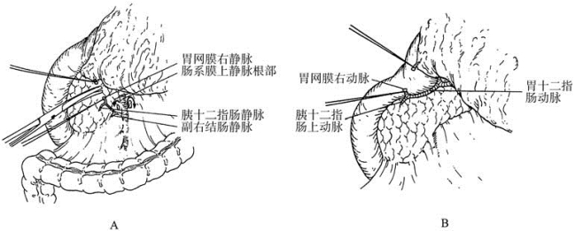 pagenumber_ebook=336,pagenumber_book=321