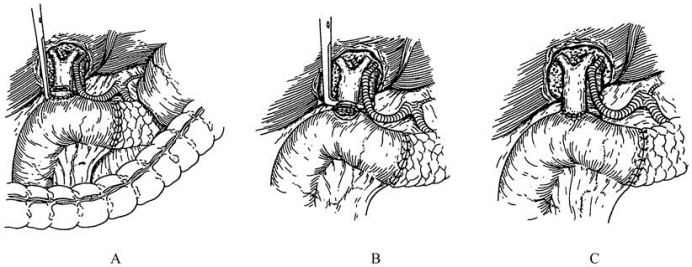 pagenumber_ebook=497,pagenumber_book=482