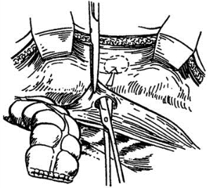 pagenumber_ebook=412,pagenumber_book=397