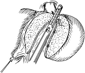 pagenumber_ebook=482,pagenumber_book=467