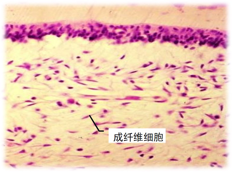 3.3-3 成纤维细胞.jpg