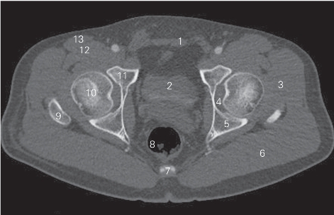pagenumber_ebook=93,pagenumber_book=84