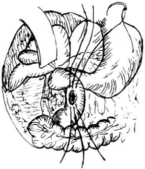 pagenumber_ebook=565,pagenumber_book=550