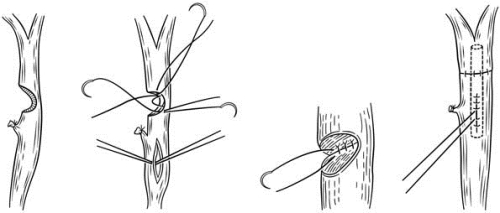 pagenumber_ebook=230,pagenumber_book=215