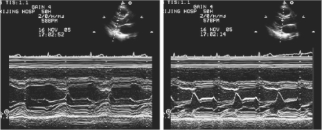 pagenumber_ebook=223,pagenumber_book=223