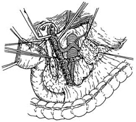 pagenumber_ebook=494,pagenumber_book=479