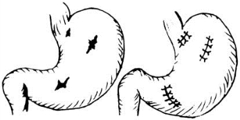 pagenumber_ebook=562,pagenumber_book=547