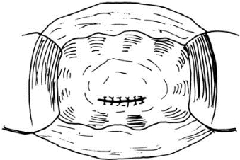 pagenumber_ebook=526,pagenumber_book=511