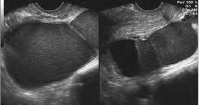 pagenumber_ebook=691,pagenumber_book=691