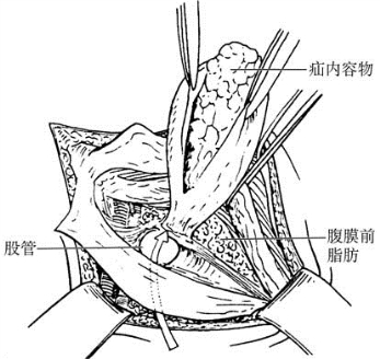 pagenumber_ebook=596,pagenumber_book=581