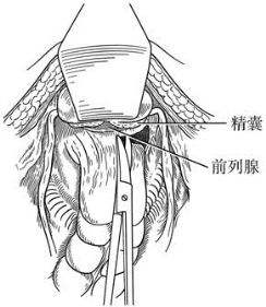 pagenumber_ebook=410,pagenumber_book=395