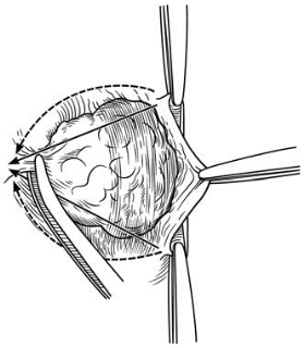 pagenumber_ebook=602,pagenumber_book=587