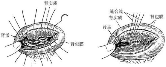 pagenumber_ebook=124,pagenumber_book=109