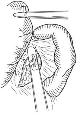 pagenumber_ebook=514,pagenumber_book=499