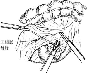 pagenumber_ebook=397,pagenumber_book=382