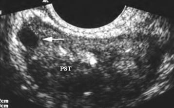 pagenumber_ebook=644,pagenumber_book=644