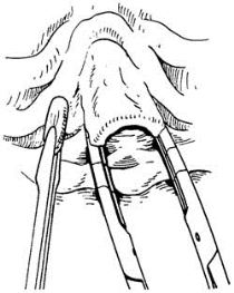 pagenumber_ebook=443,pagenumber_book=428