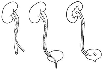 pagenumber_ebook=241,pagenumber_book=226