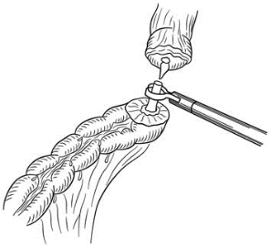 pagenumber_ebook=426,pagenumber_book=411