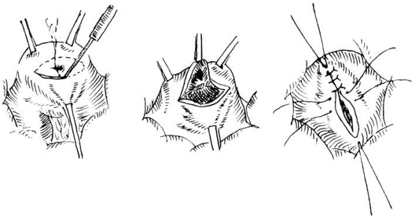 pagenumber_ebook=557,pagenumber_book=542