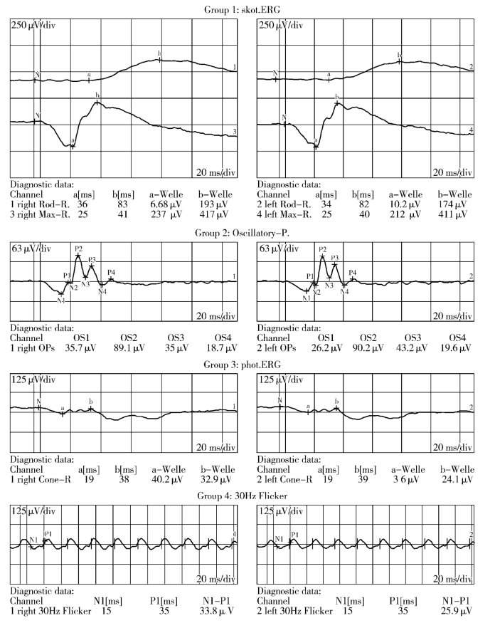 pagenumber_ebook=151,pagenumber_book=126