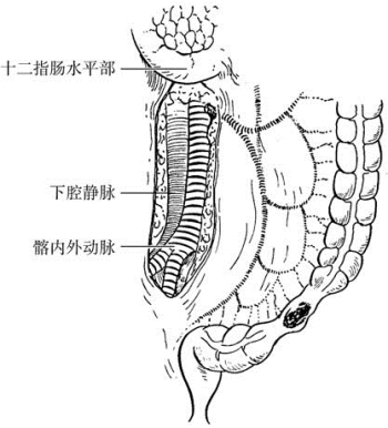 pagenumber_ebook=392,pagenumber_book=377