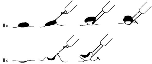 pagenumber_ebook=520,pagenumber_book=505