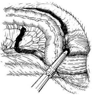 pagenumber_ebook=529,pagenumber_book=514