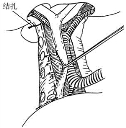 pagenumber_ebook=469,pagenumber_book=454