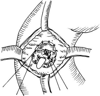 pagenumber_ebook=537,pagenumber_book=522