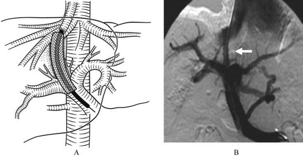 pagenumber_ebook=296,pagenumber_book=281