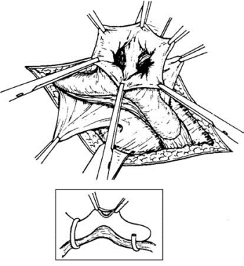pagenumber_ebook=588,pagenumber_book=573