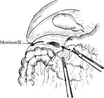 pagenumber_ebook=397,pagenumber_book=382