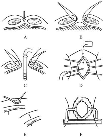 pagenumber_ebook=161,pagenumber_book=146