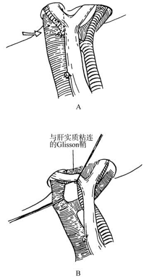 pagenumber_ebook=469,pagenumber_book=454