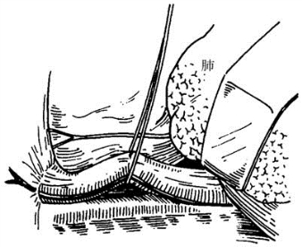 pagenumber_ebook=319,pagenumber_book=304