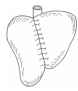 pagenumber_ebook=296,pagenumber_book=288