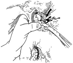 pagenumber_ebook=125,pagenumber_book=110