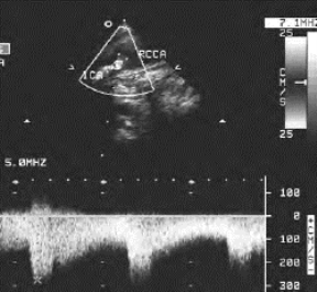 pagenumber_ebook=480,pagenumber_book=480