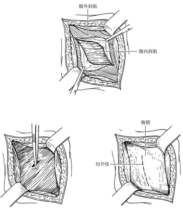 pagenumber_ebook=542,pagenumber_book=527