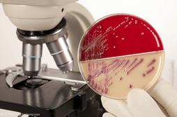 微生物学及检验