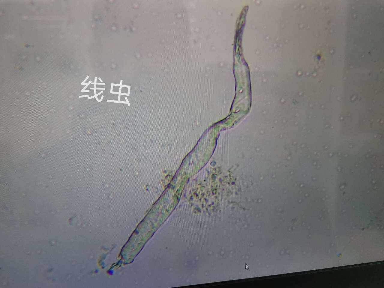 线虫1.jpg